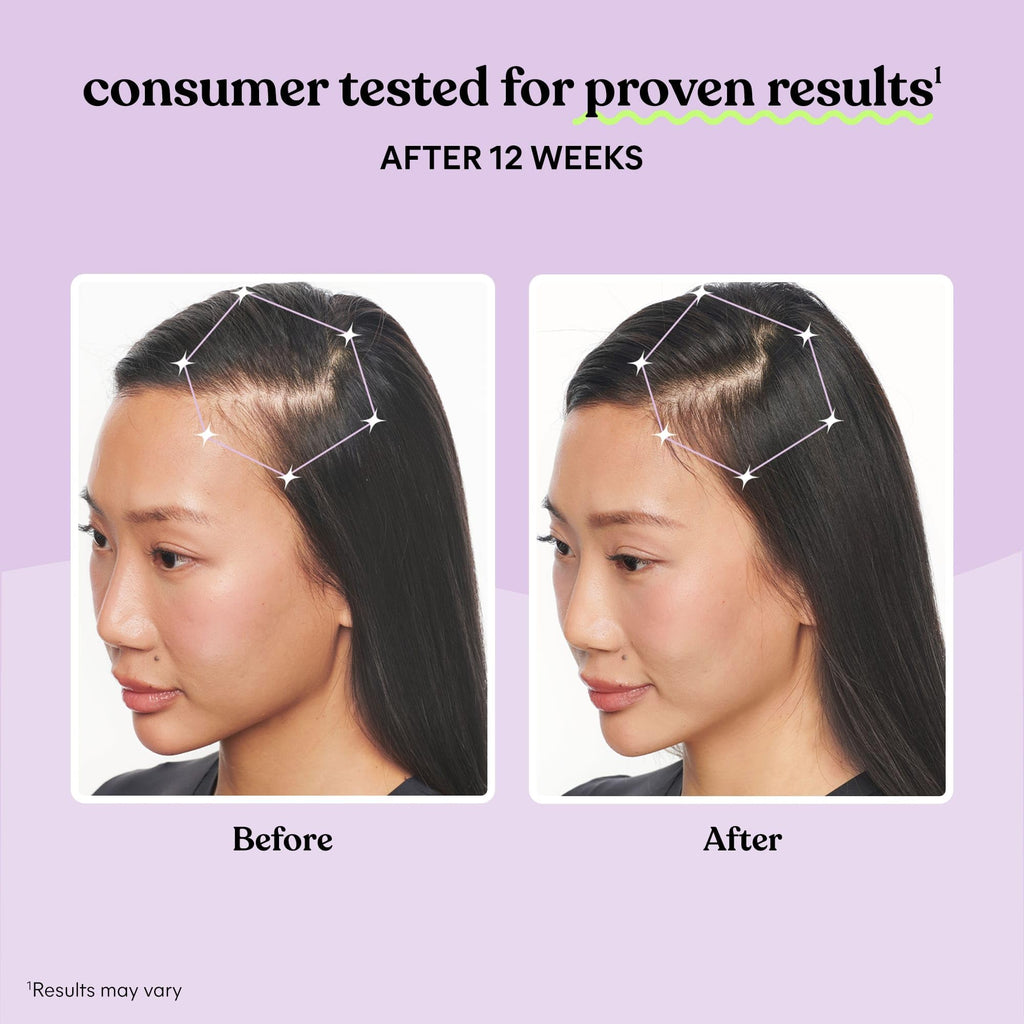 Hair Growth Capsules 30-Day Supply W70300