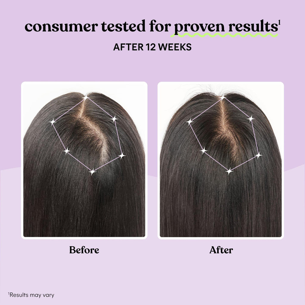Hair Growth Capsules 30-Day Supply W70300